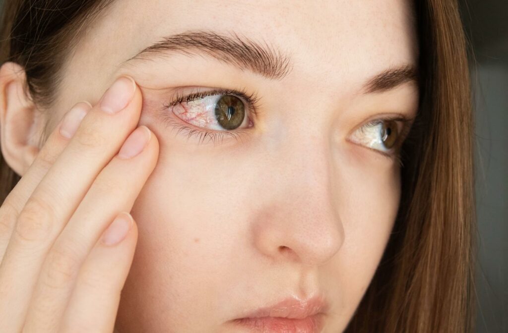 A person with a red irritated eye